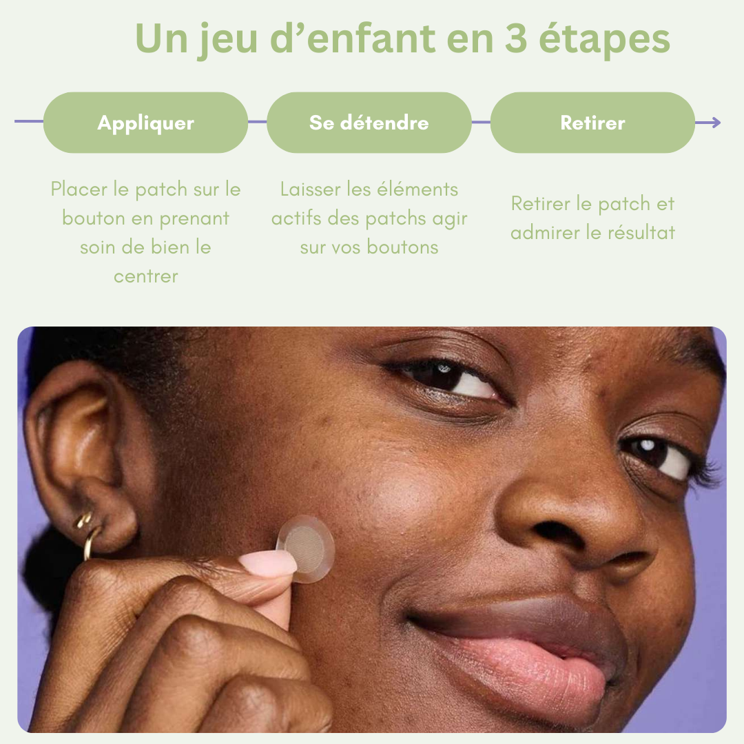 Patch micro-aiguilles Réduit les boutons douloureux en une nuit (sans les percer)