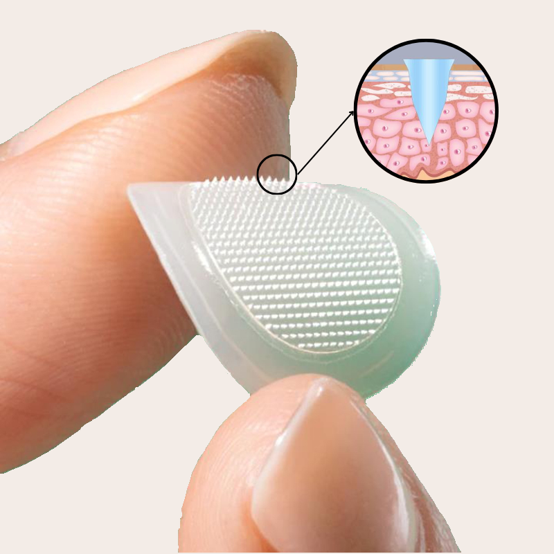 Patch micro-aiguilles Réduit les boutons douloureux en une nuit (sans les percer)