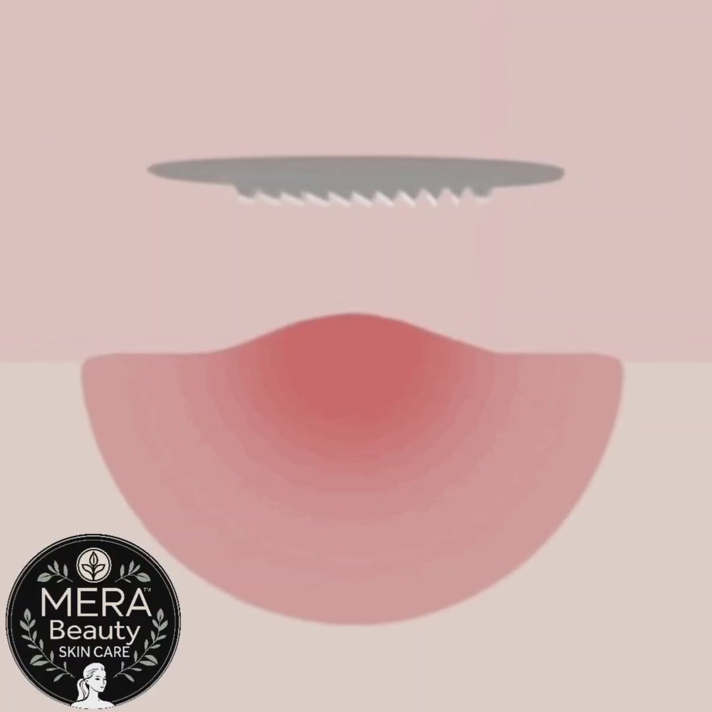 Microneedles Patches